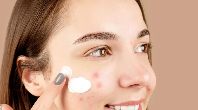 Produtos para Tratar Acne